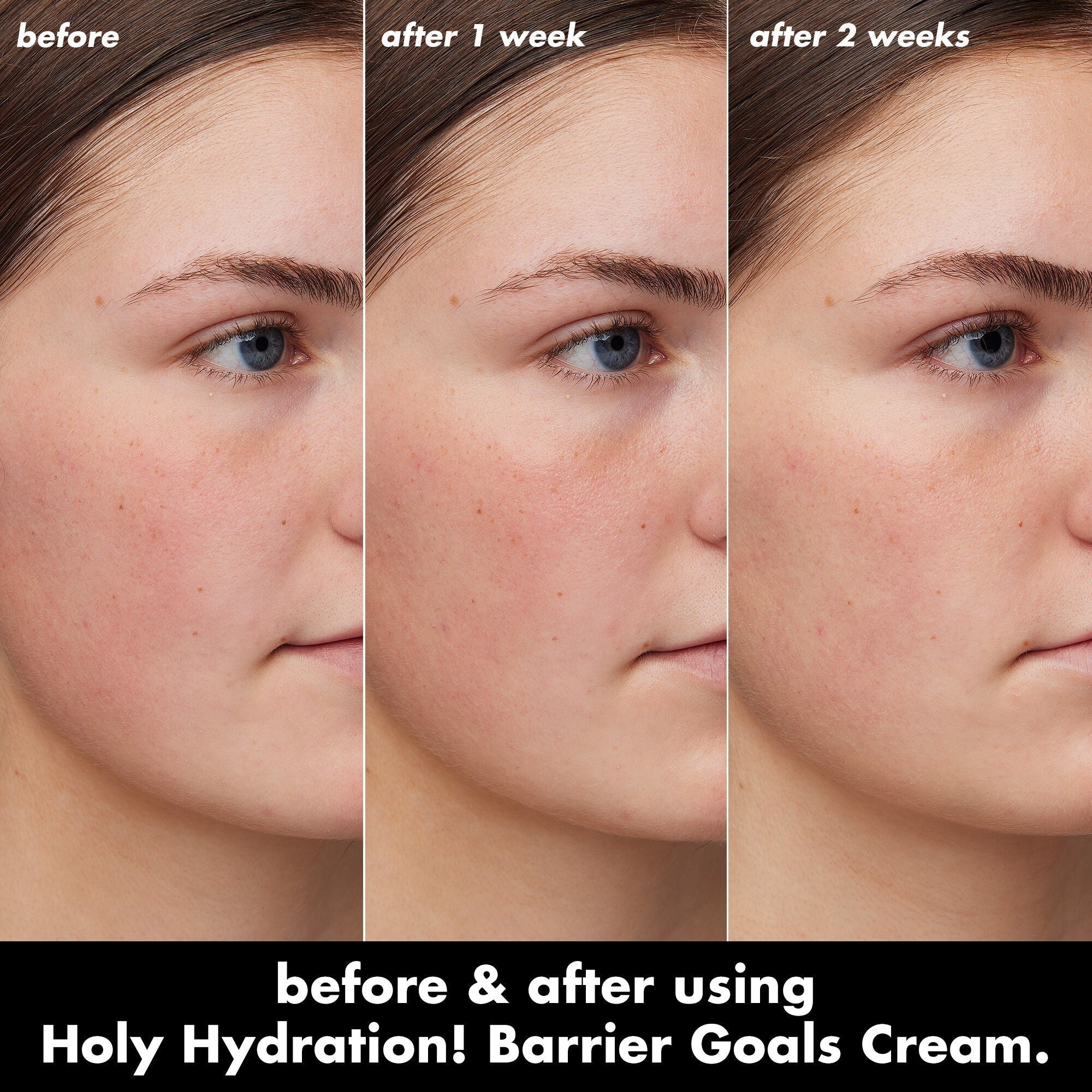 Before and after using Holy Hydration! Barrier Goals Cream after 1 week and 2 weeks