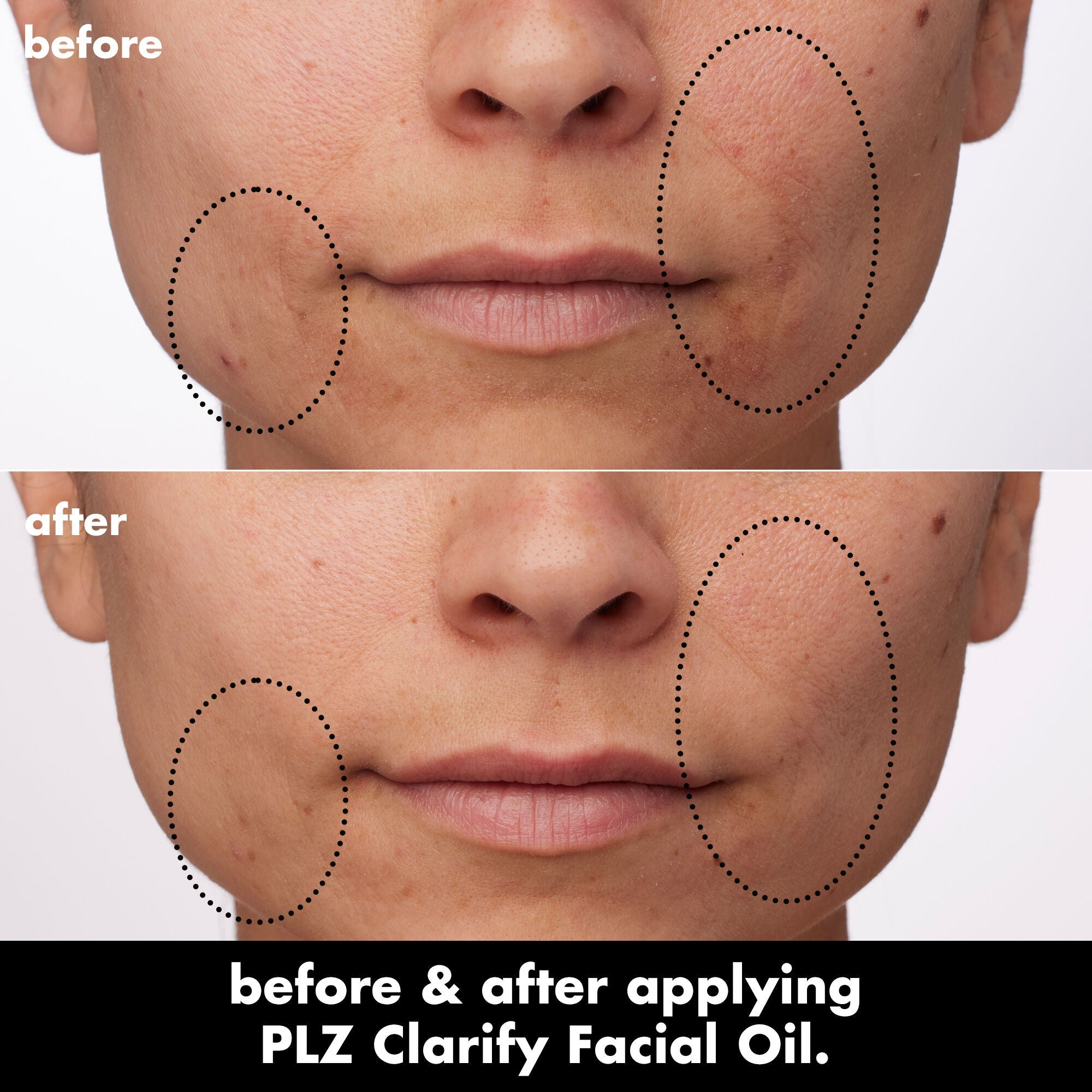 PLZ Clarify Facial Oil